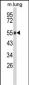 GC Antibody      (Center)