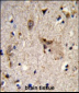ALDH18A1 Antibody (Center)