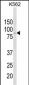 ALDH18A1 Antibody (Center)