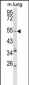 KCNQ1 Antibody (Center)