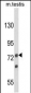 ANGEL1 Antibody (C-term)
