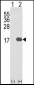 IL1F8 Antibody (N-term)