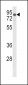 LDLR Antibody (Center)