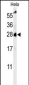 RAB8A Antibody