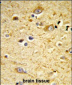 GSTA4 Antibody (N-term)