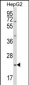 GSTA4 Antibody (N-term)