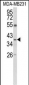 ARG1 Antibody (C-term)