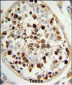 C13orf3 Antibody (Center)