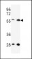 C13orf3 Antibody (Center)