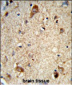 DAB1 Antibody (Center)