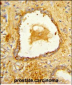 DAB2 Antibody (C-term)