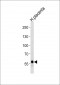 DAB2 Antibody (C-term)