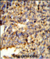 FCGR2C Antibody (C-term)