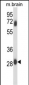 FCGR2C Antibody (C-term)