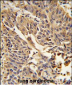 JUP Antibody (C-term)