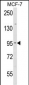 JUP Antibody (C-term)