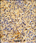 LY75 Antibody (Center)