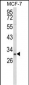 NKX3-1 Antibody (Center)