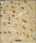 DPP10 Antibody (Center)