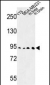 DPP10 Antibody (Center)