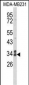 CLTA Antibody (Center)