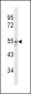 NAMPT Antibody (Center)