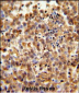 CLGN Antibody (Center)