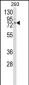 CLGN Antibody (Center)