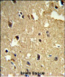 TBB1 Antibody