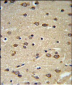 DLK2 Antibody (C-term)