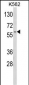 CDK5RAP1 Antibody (C-term)