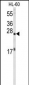 EIF4E Antibody