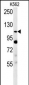 Semaphorin 5A Antibody