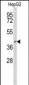 FOXP3 Antibody (Center)