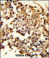 HSPH1 Antibody (Center)