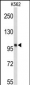 HSPH1 Antibody (Center)