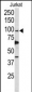 POLD1 Antibody (Center)