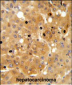 PRKAA1 Antibody