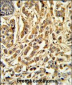 CYP21A2 Antibody (Center)