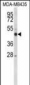 CYP21A2 Antibody (Center)