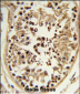 CHPF Antibody (Center)