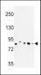 CHPF Antibody (Center)