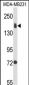 ITGA2 Antibody (C-term)