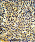 BPI Antibody (Center)