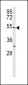 BPI Antibody (Center)