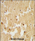 ESRRB Antibody (Center)