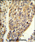 PKM2 (N-term E131) Antibody