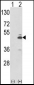 PKM2 (N-term E131) Antibody