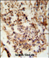 ACR Antibody (C-term)