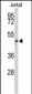 ACR Antibody (C-term)